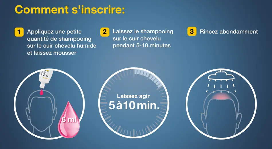 De anti-roosshampoo van Nizoral is heel eenvoudig te gebruiken.