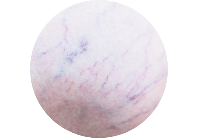 Verkleuringen aan de huid