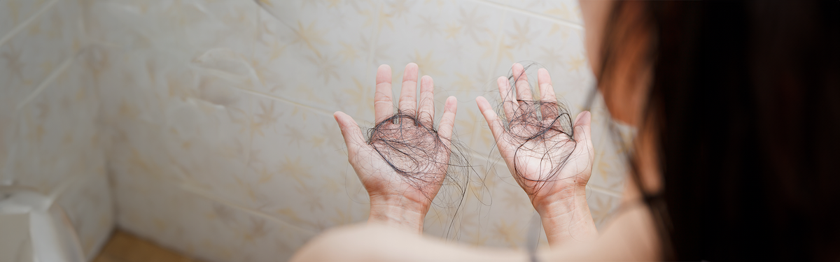 Perte de cheveux chez la femme
