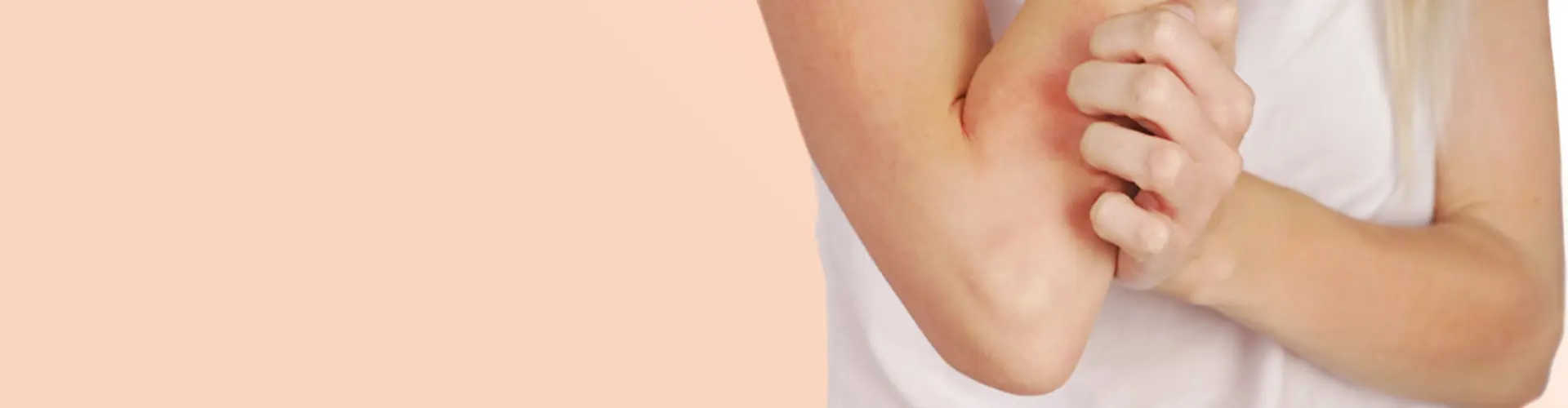 Lees op deze pagina alles over eczeem.