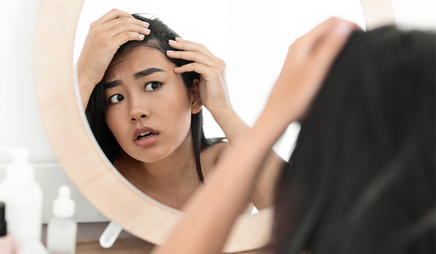 Les causes de la perte de cheveux