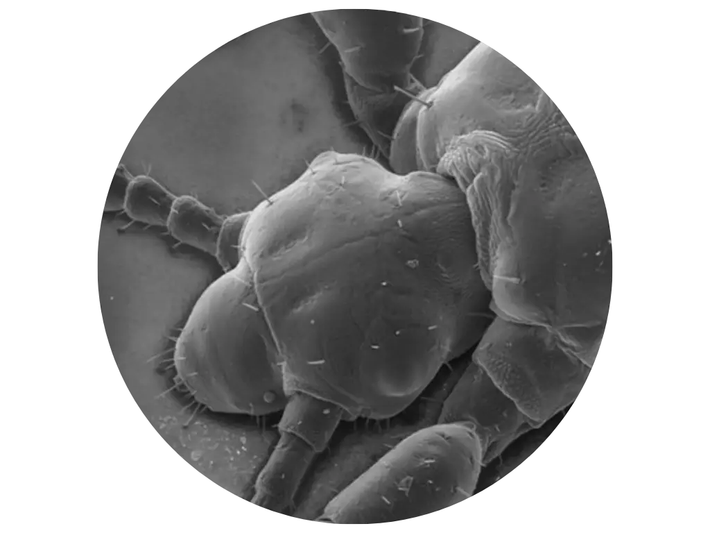 Hoe zien luizen en neten eruit?