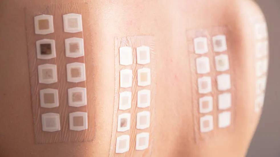 Découvrez ici comment traiter une réaction cutanée allergique.