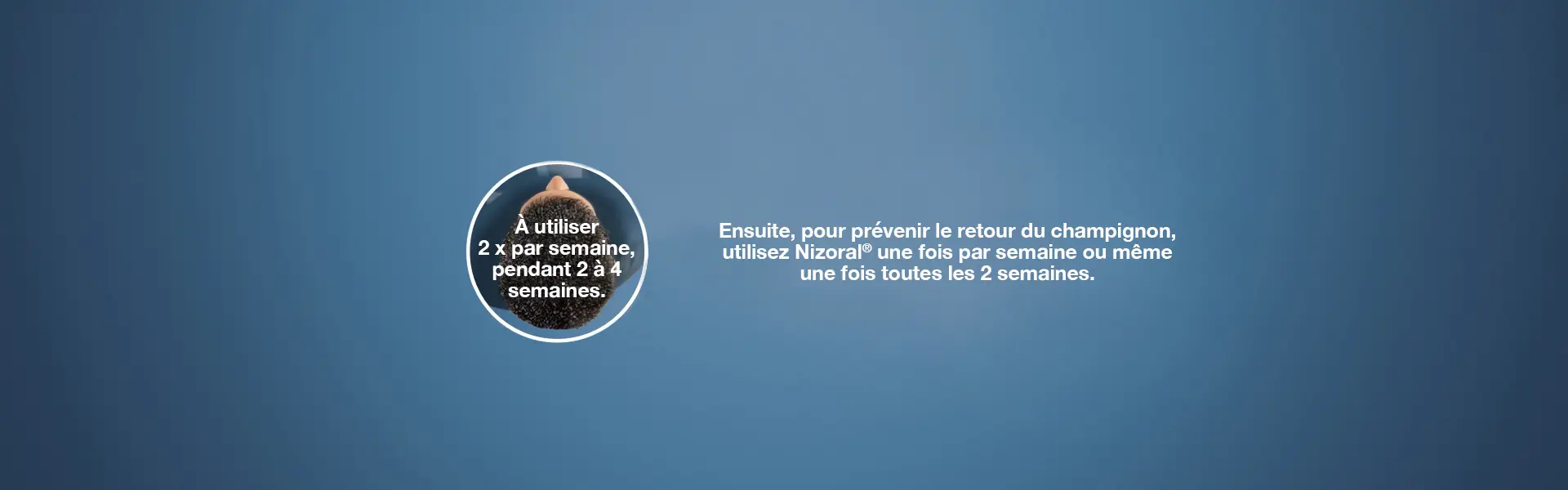 En utilisant Nizoral, vous pouvez dire adieu aux autres shampoings antipelliculaires.