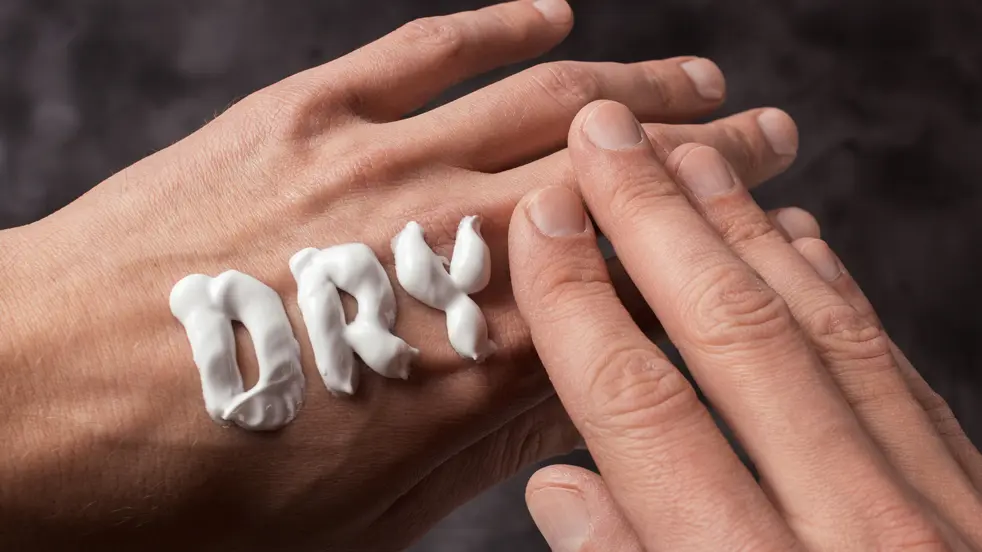 Mensen met een droge huid hebben vaker last van eczeem.