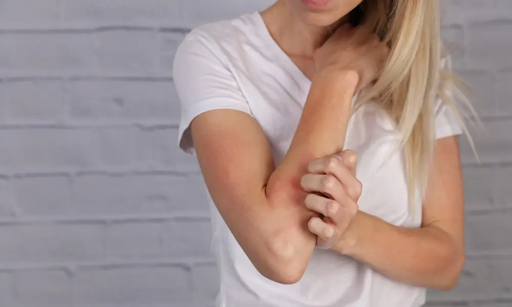 Ontdek hier alles over eczeem.