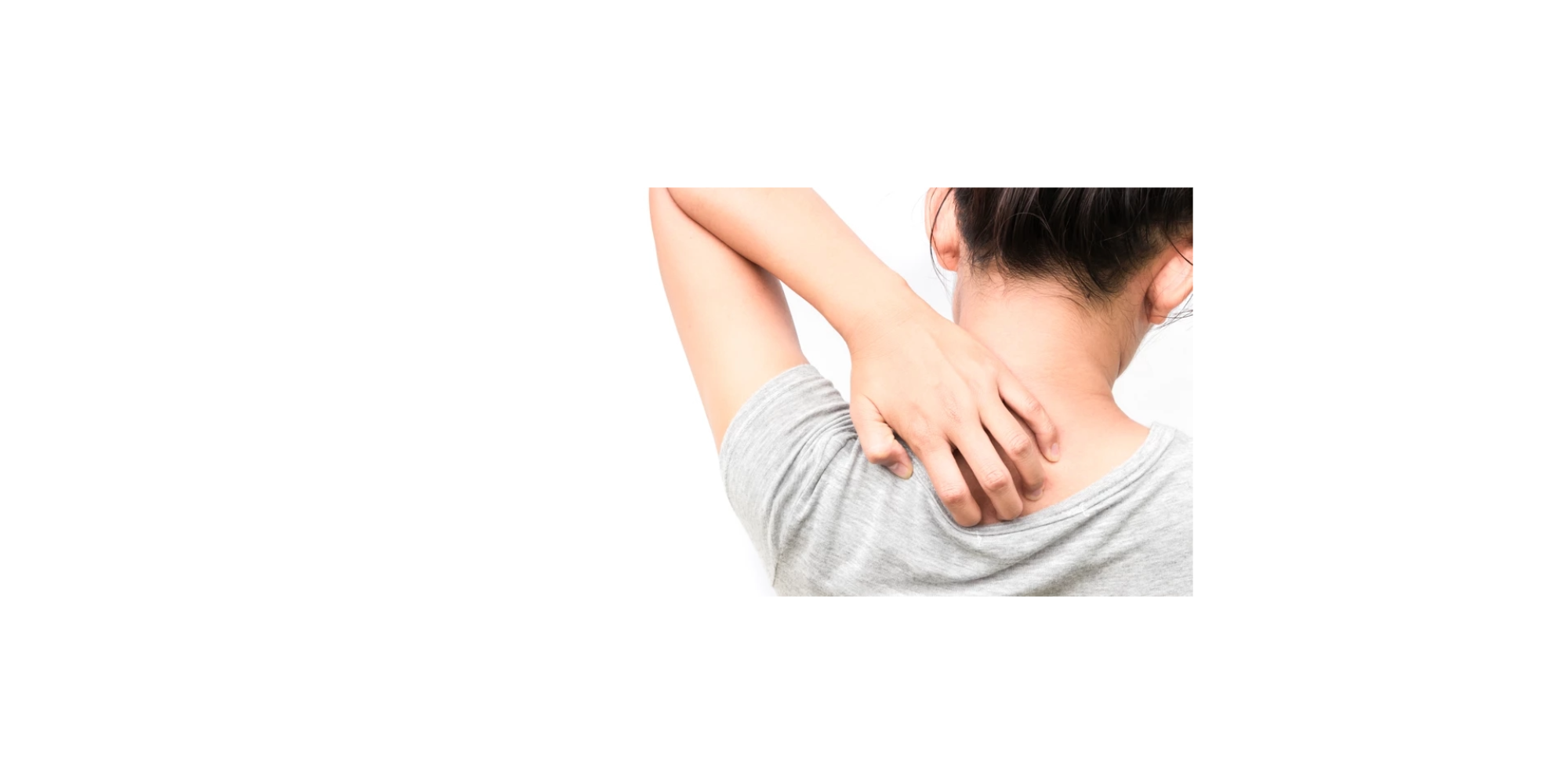 Arrêtez de vous gratter