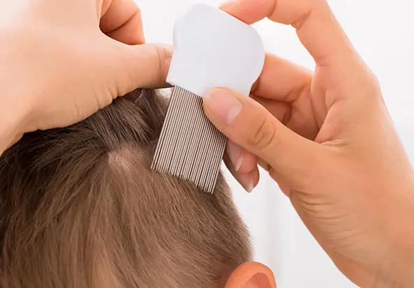 Lees hier hoe je luizen kan opsporen.