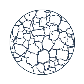Een droge huid valt onder de oorzaken van roos. 