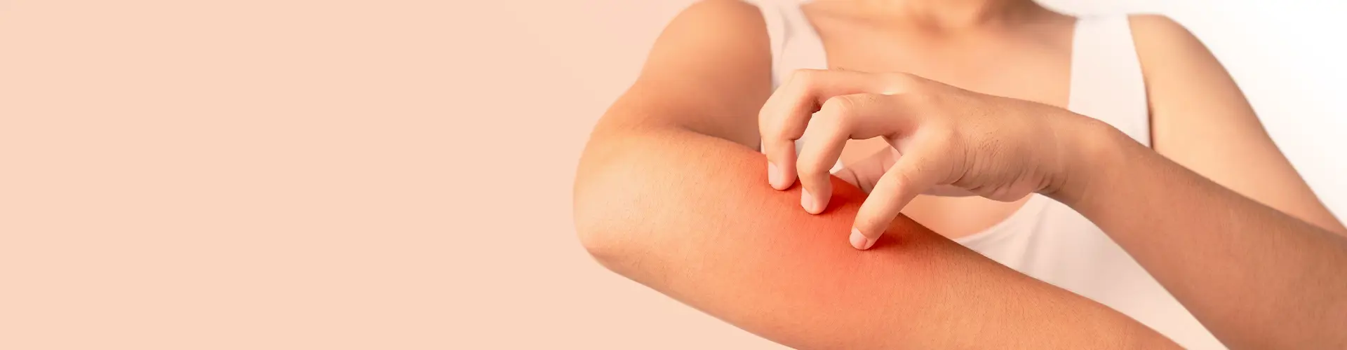 Ontdek op deze pagina alles over een allergische huidreactie.