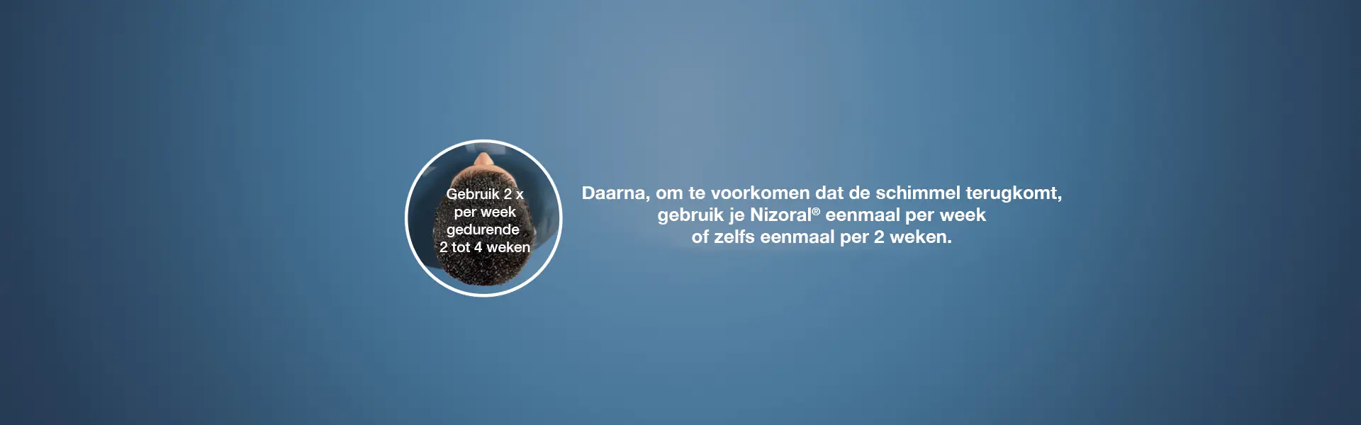 Door Nizoral te gebruiken kan je vaarwel zeggen aan andere anti-roosshampoos.