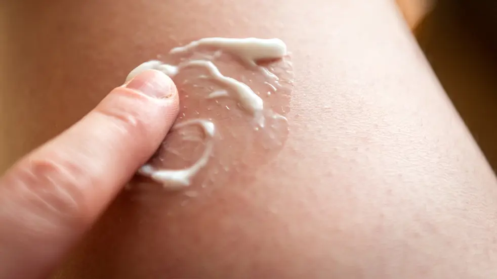 De behandeling van een allergische huidreactie is meestal symptomatisch.