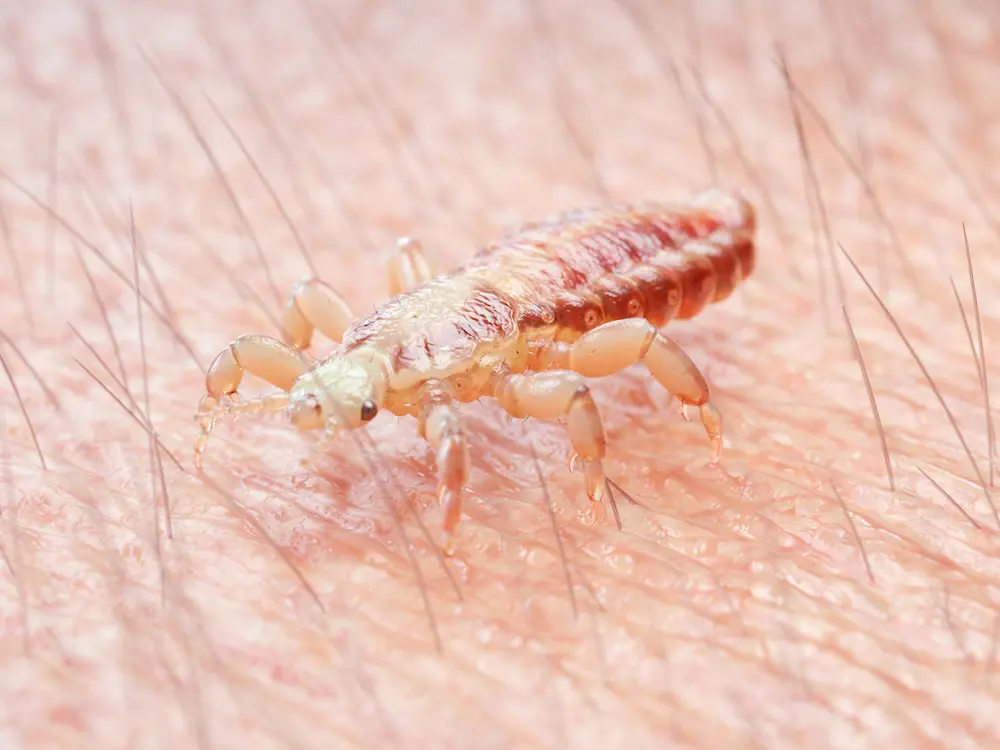 Heb je luizen gevonden?